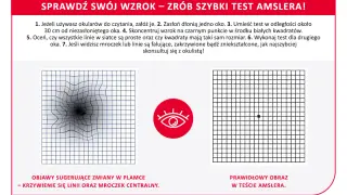 Test Amslera pokazuje zniekształcone linie, sugerując zmiany w plamce żółtej. Domowe sposoby na zwyrodnienie plamki żółtej mogą obejmować regularne badania wzroku.