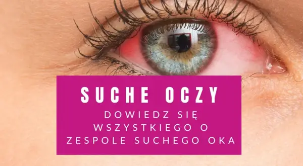 Czerwone, podrażnione oko. Tekst informuje o objawach zespołu suchego oka.