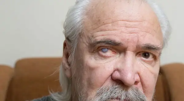 Zaćma: Operacja to jedyna szansa? Poznaj metody i soczewki!