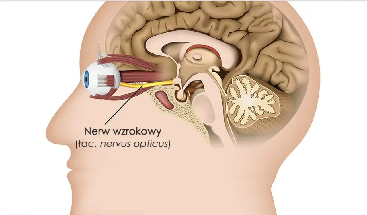 Anatomia oka i mózgu, z zaznaczonym nerwem wzrokowym. Informacje o zanik nerwu wzrokowego leczenie w Polsce.