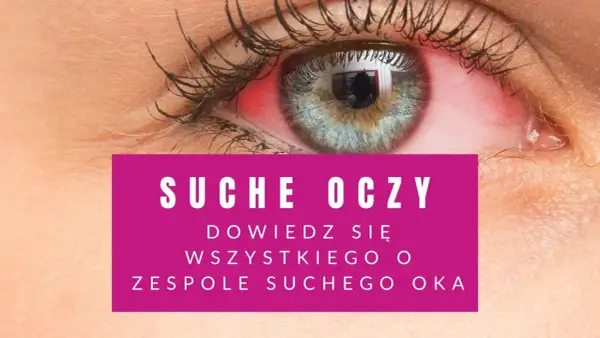 Czerwone, podrażnione oko. Tekst informuje o objawach zespołu suchego oka.